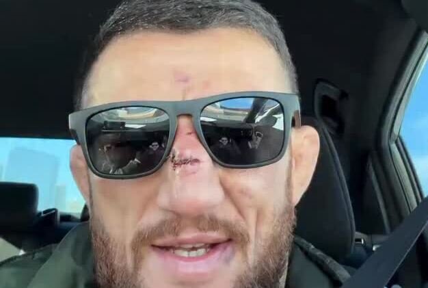 “რაღა ეხლა წააგე ბიჭო და დატოვე ეს ხელოსნები უფულოდ” – მერაბ დვალიშვილი ქართველი ქომაგის კომენტარმა გააღიზიანა – როგორ უპასუხა მებრძოლმა მასზე დაწერილ სტატუსს ?